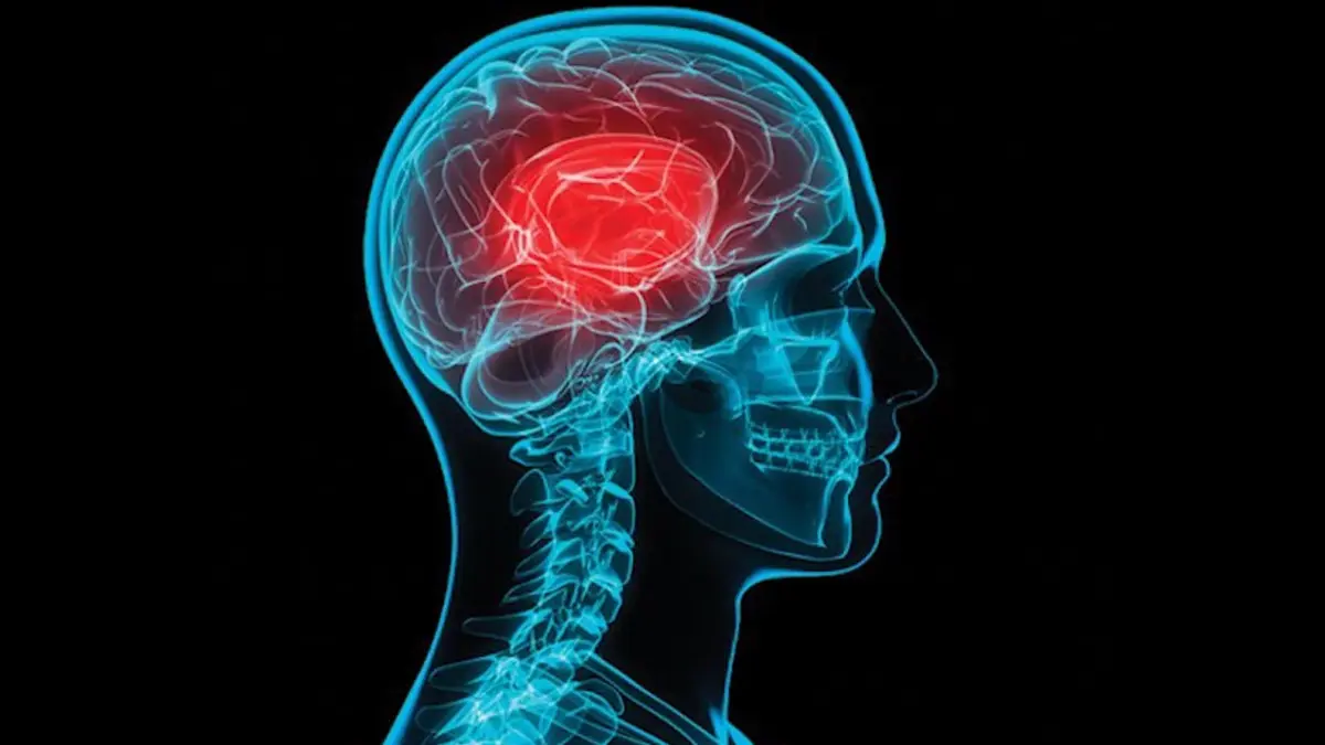 Baterías neurológicas que evalúan percepción - Que evalúa el Nepsy II baterias neurologicas que evalúan percepcion - Que evalúa el Nepsy II